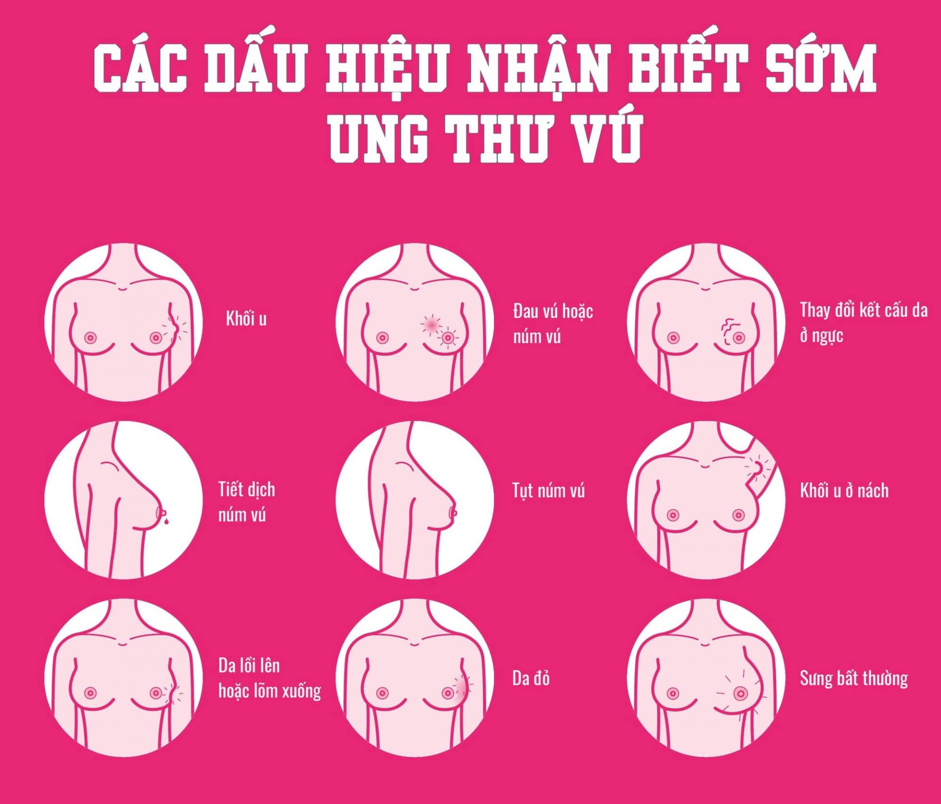 cac-trieu-chung-ung-thu-vu